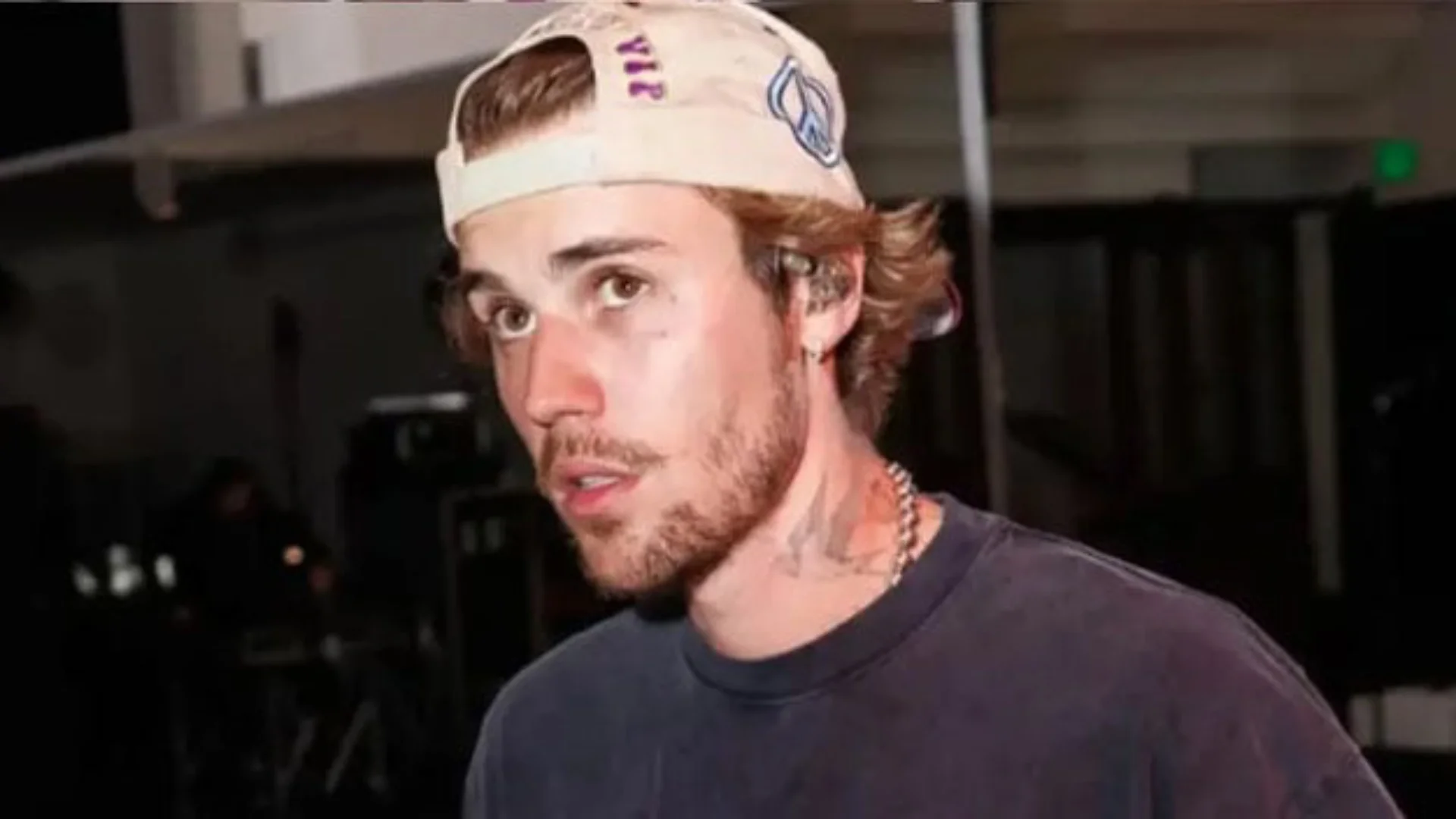 El cantante sufrió una caída reciente mientras manejaba su Onewheel. Aun con la dolorosa lesión, continúa ensayando para su esperado