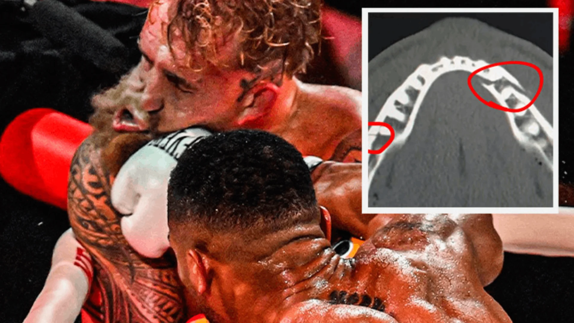 El youtuber Jake Paul termina con doble fractura de mandíbula tras derechazo de Anthony Joshua