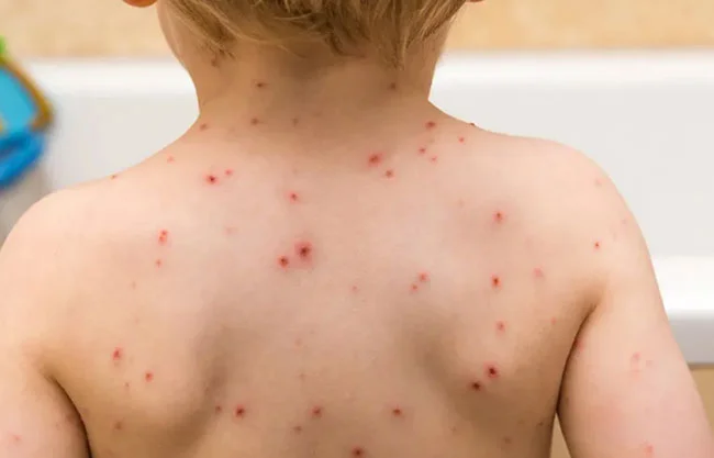 El gobierno capitalino reforzará la estrategia de vacunación con la instalación de entre cinco y seis macrocentros.