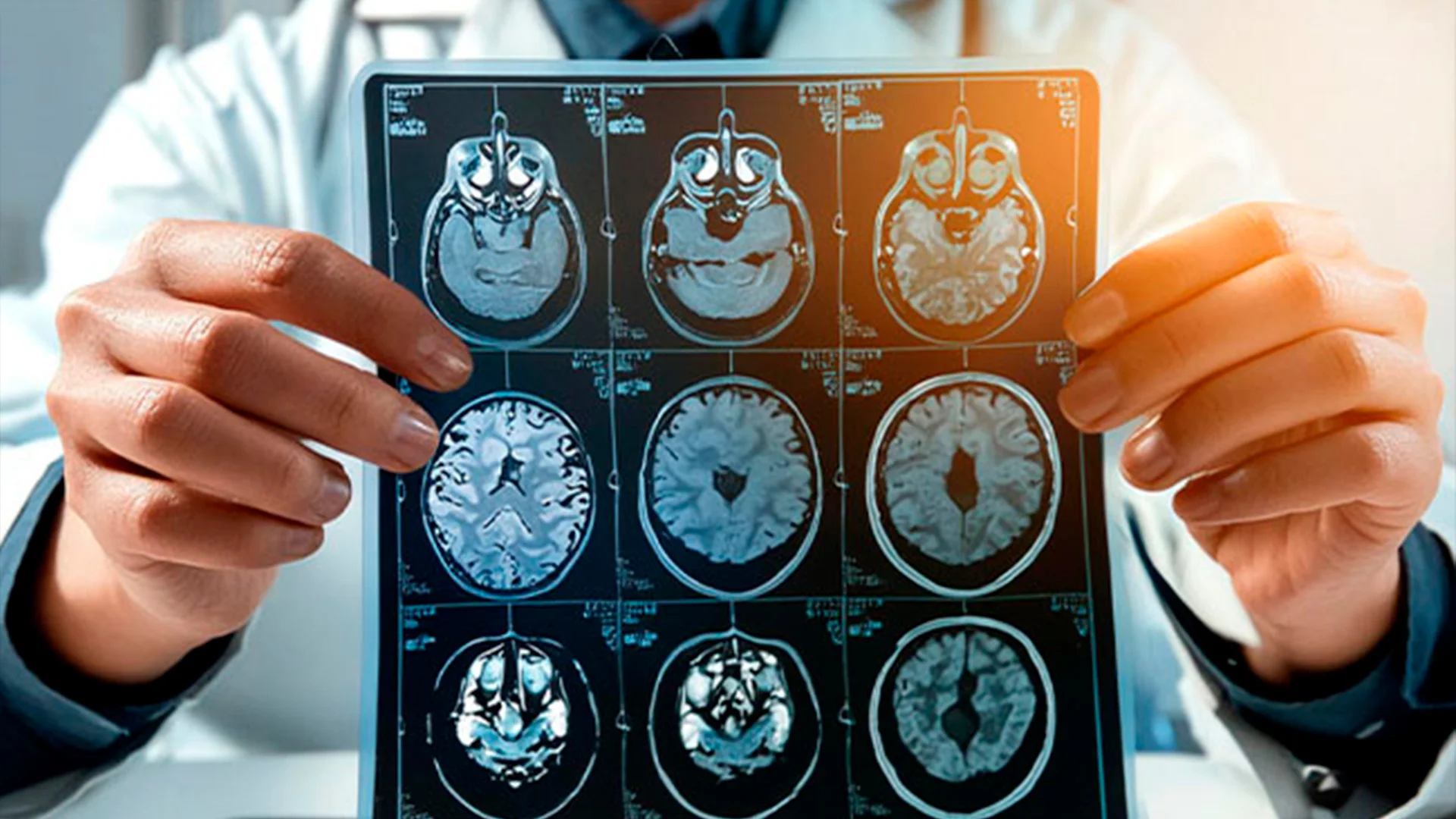 La prueba fue creada por el Centro de Cerebro y Neurotecnología y se basa en biomarcadores en sangre.