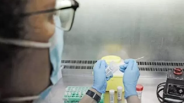 11 posibles casos de viruela del mono en Jalisco están en observación