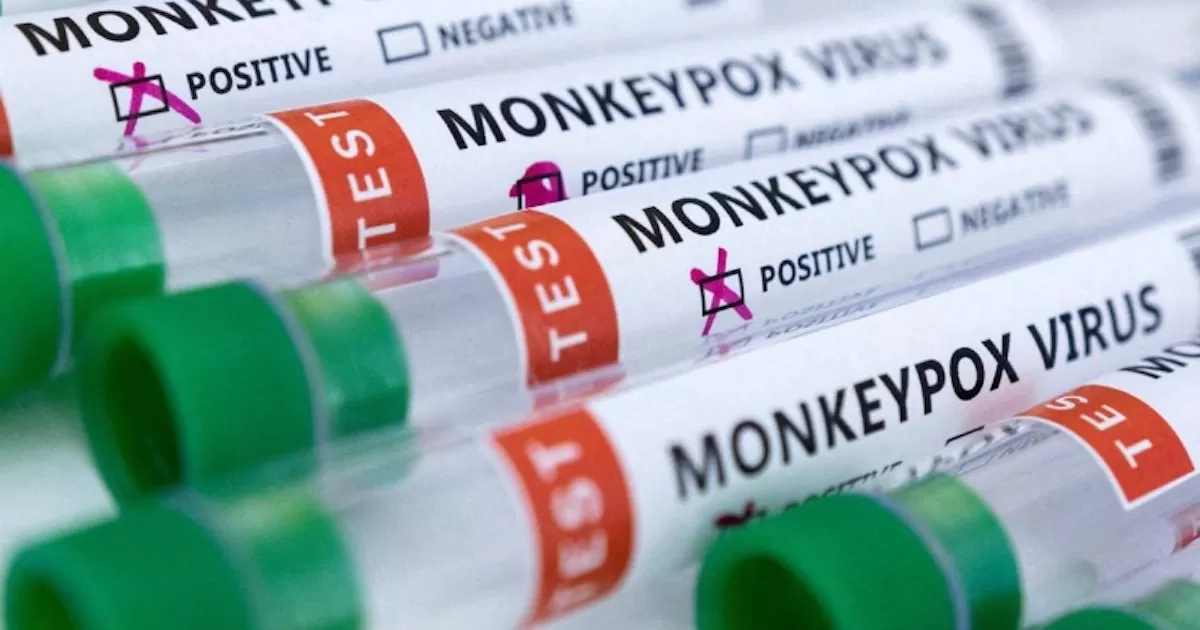 Rusia confirma primer caso de viruela del mono