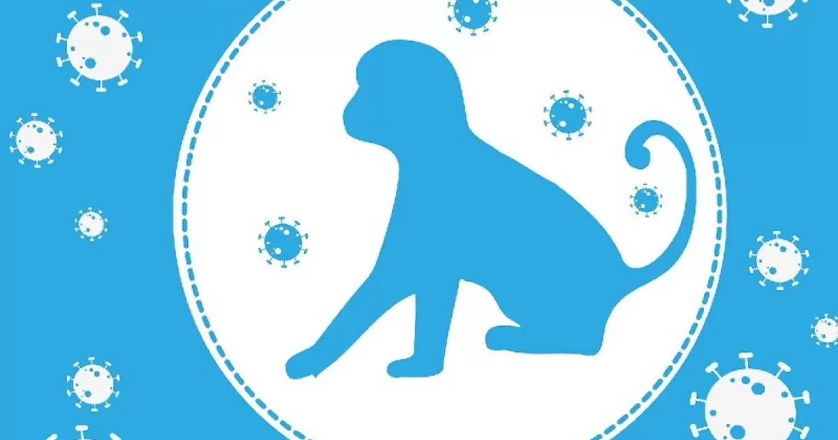 Sinaloa reporta su primer caso de viruela del mono