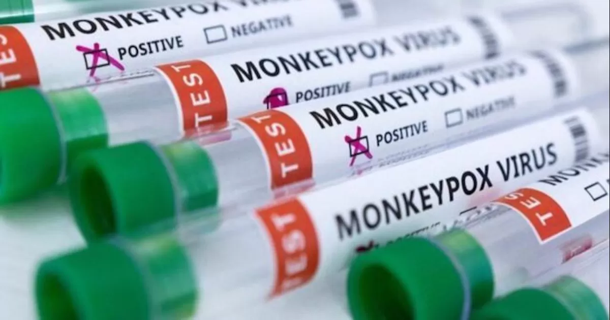 EU detecta por primera vez 2 casos de viruela del mono en niños