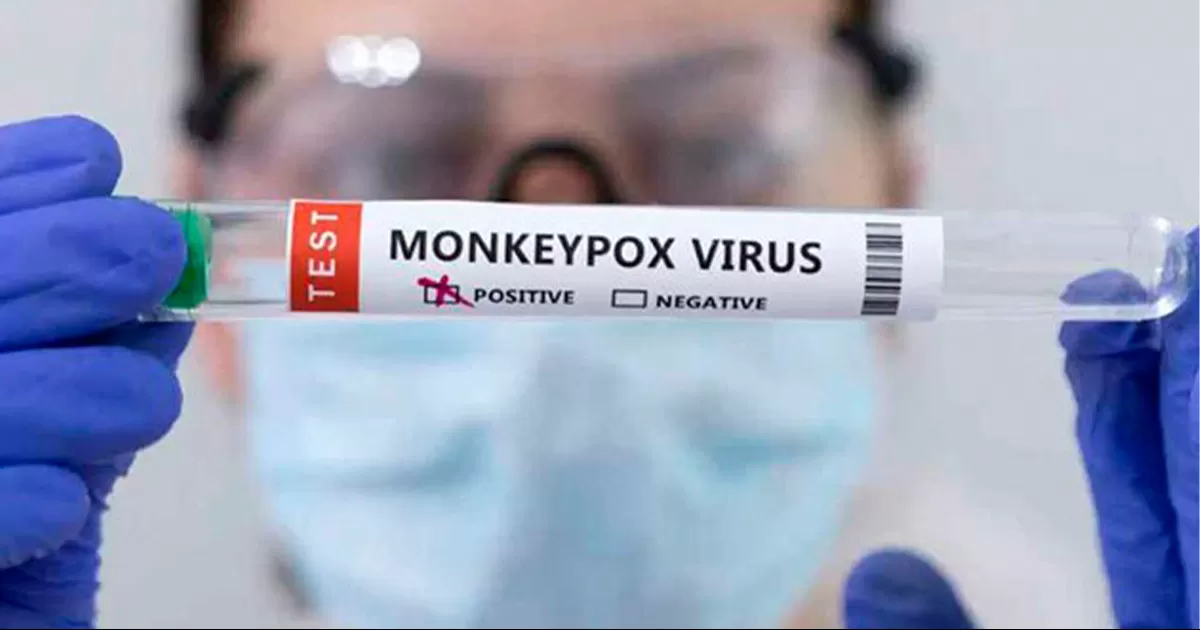 En el mundo se han declarado ya mÃ¡s de 16 mil casos de viruela del mono, cinco de ellos mortales.