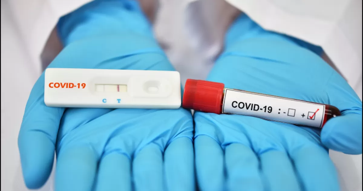 Al dÃ­a de hoy el estado tiene un total de 169,640 casos y  8,859 decesos.