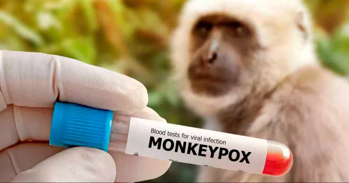 La OMS da nuevos nombres a las variantes de la viruela del mono