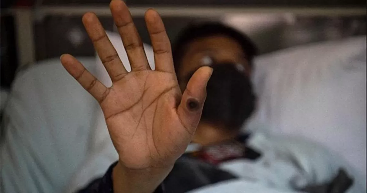 EstÃ¡ presente en 92 paÃ­ses y ha provocado un total de doce muertes desde que se declarÃ³ el actual brote