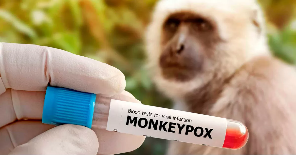 El 10 de agosto presentÃ³ los primeros sÃ­ntomas, pero fue hasta el jueves 25 de agosto cuando se le tomÃ³ la muestra.