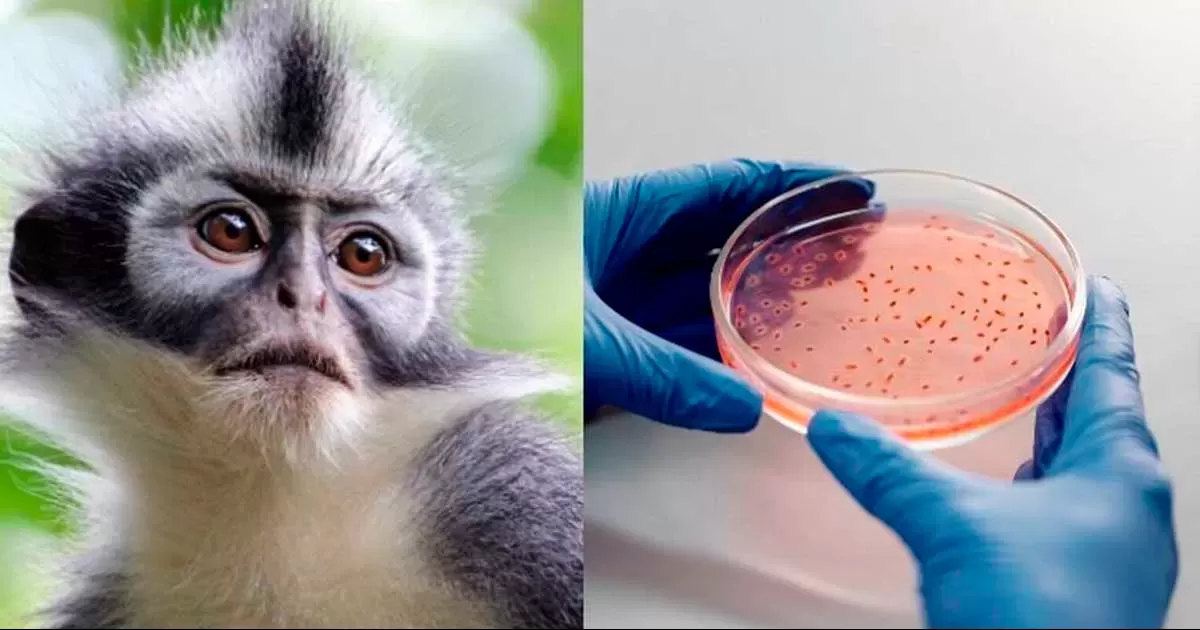 Detectan en Coahuila nuevo contagio de viruela símica, ahora en Monclova