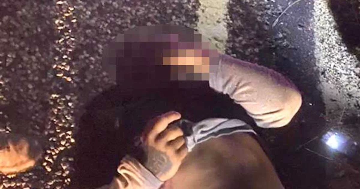 Arrollan a indocumentado; lo llevan a hospital de San Antonio