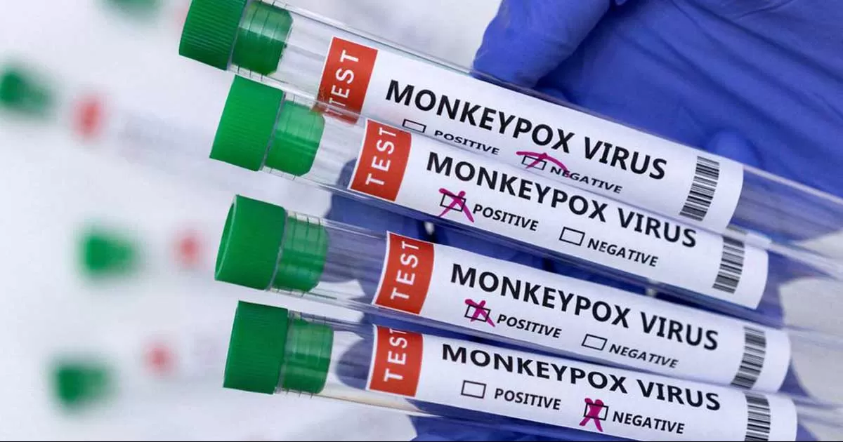 México suma 3 mil 292 casos confirmados de viruela de mono; van 4 muertes