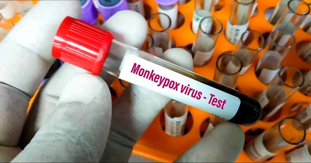 Autoridades sanitarias han implementado más medidas de prevención para los ciudadanos, especialmente en la comunidad LGBTTIQ+