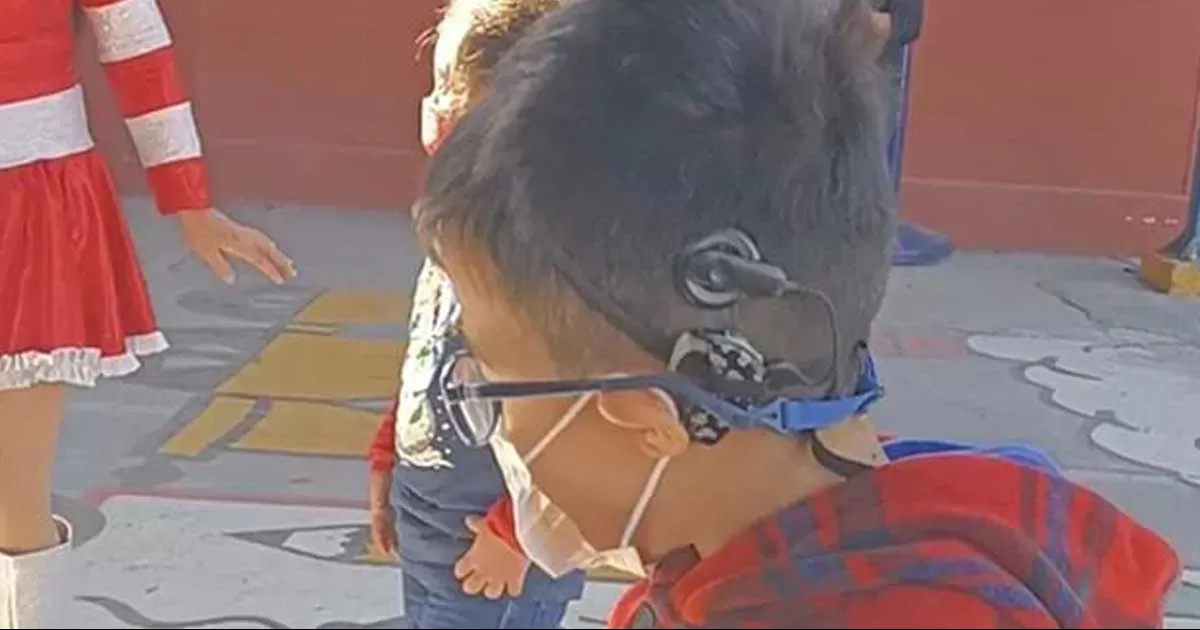 Adentro de la cabeza de Cristian trae un procesador que se conecta al aparato que se llevaron.