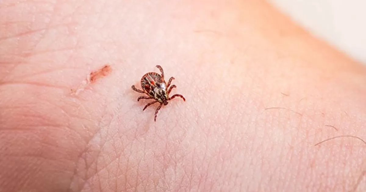 En Saltillo, reporta Salud primeras dos muertes de rickettsiosis de 2023