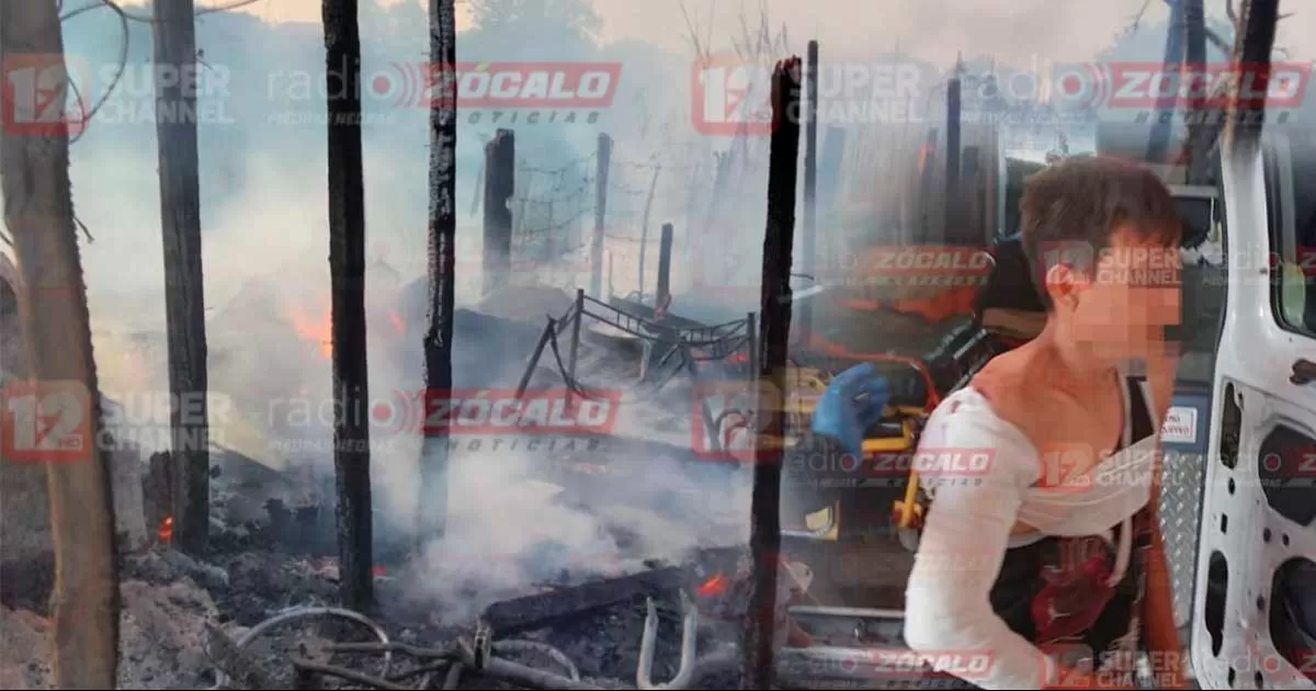 Familia sufre quemaduras de tercer grado tras incendiarse su vivienda en PN