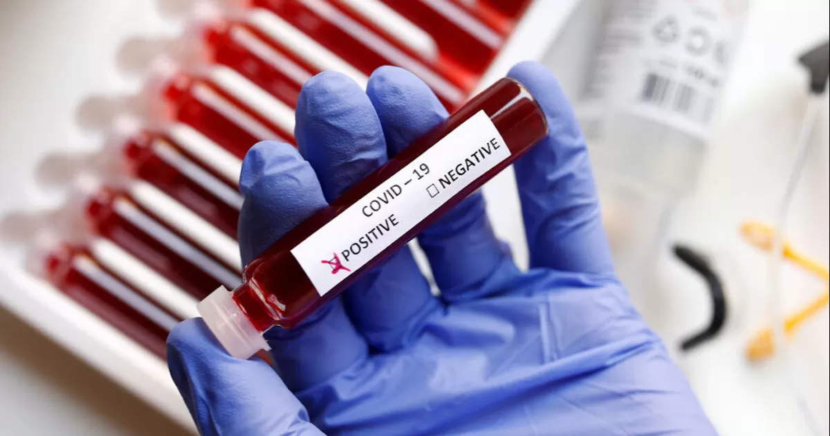 Reporte Semanal de Covid-19: Coahuila registra 31 nuevos casos, sin defunciones