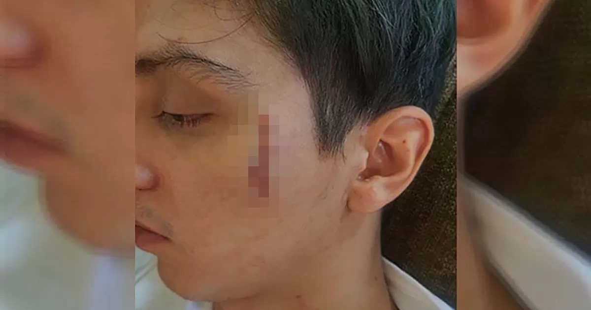 Joven saltillense denuncia a su novia por maltrato