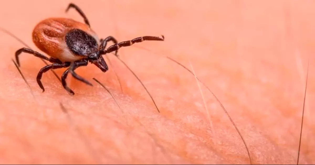 Realizan cerco epidemiológico por caso sospechoso de Rickettsia. Se espera resultado de muestra para la próxima semana