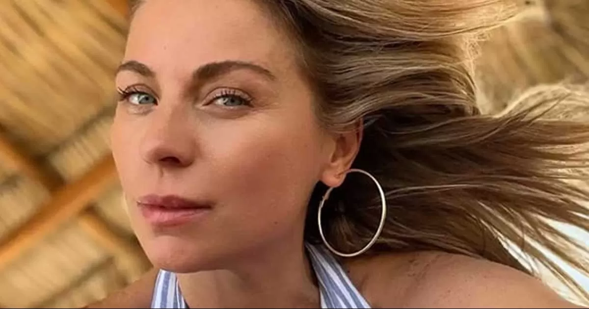 El cantante la padece desde 2005 tras un accidente en el escenario provocado por el equipo de sonido.