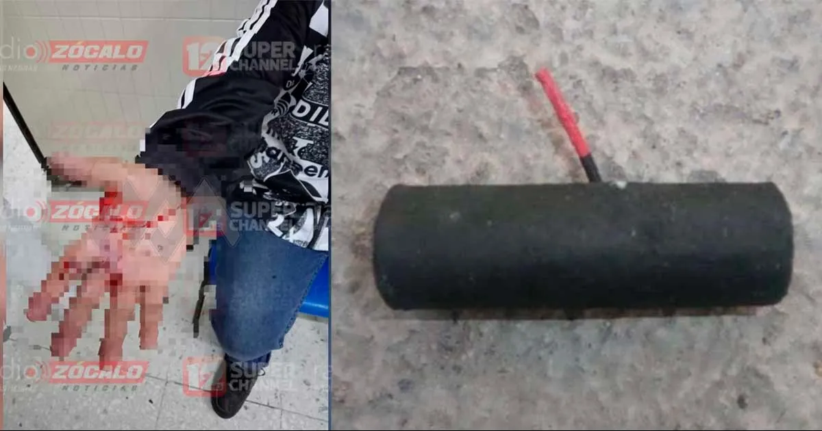 Un niño sufrió quemaduras y lesiones en la mano tras explotarle un cuete R15