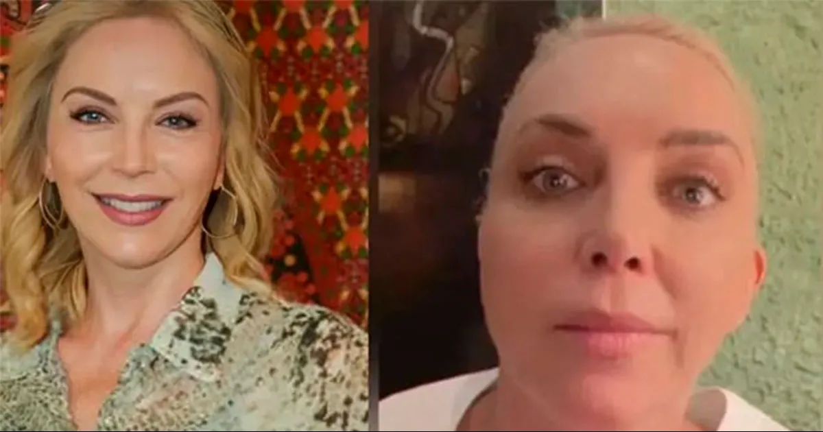 VIDEO: Laura Flores sufre un microinfarto cerebral por tratamiento estético