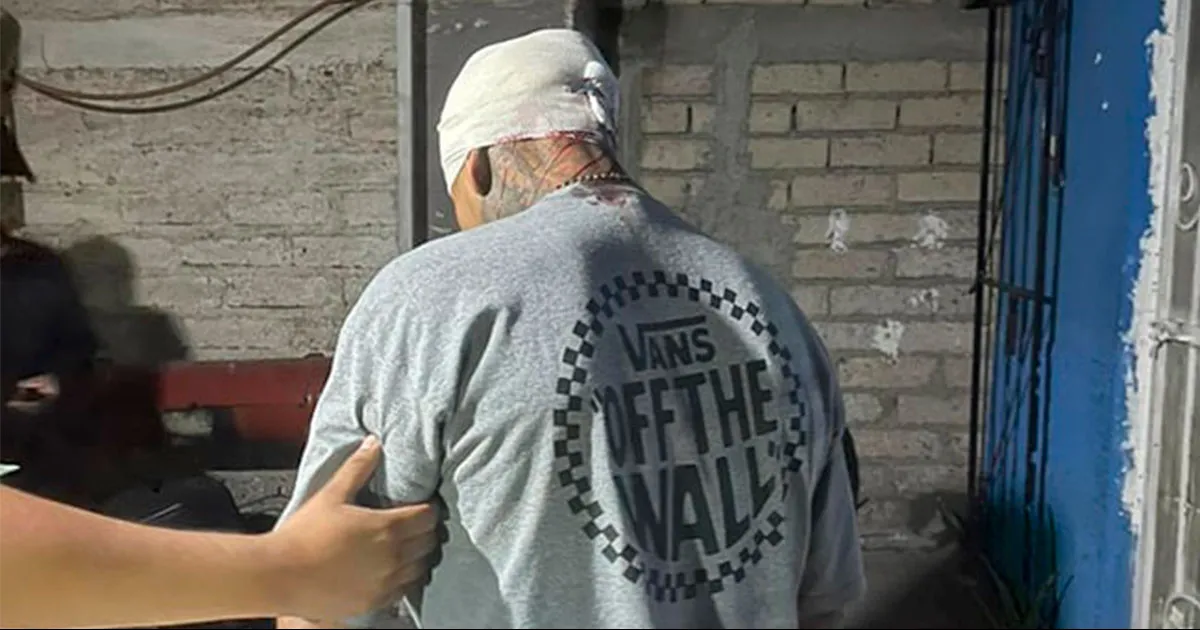 Recibe martillazo en la cabeza durante riña en la Carbonífera