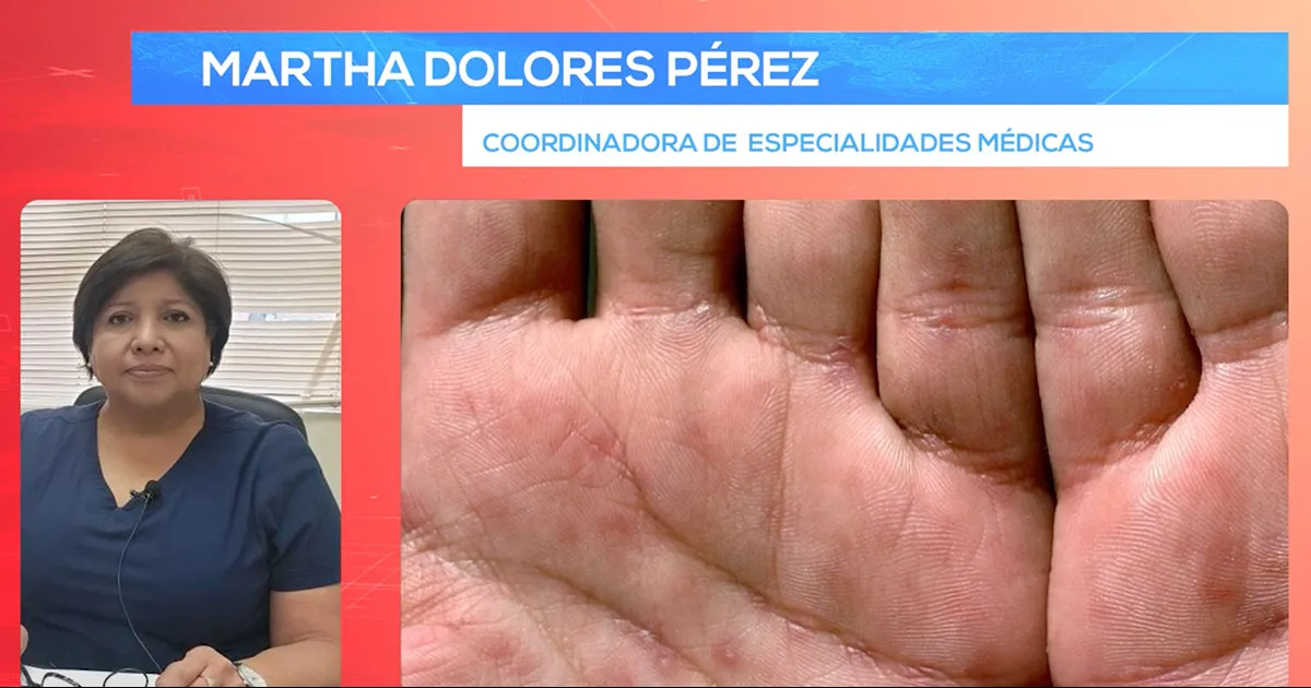 La doctora Martha Dolores comentó que algunas detecciones se han hecho tras la impartición de pláticas en escuelas secundarias y preparatorias de la región.