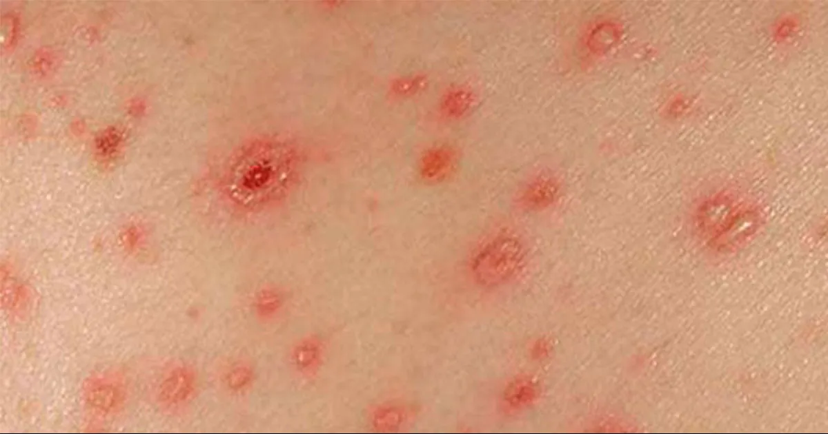 Siendo Edomex, Jalisco, Nuevo León, CdMx y Tamaulipas los cinco con mayor registro, pero este último, el estado que más disparó su propia estadística.