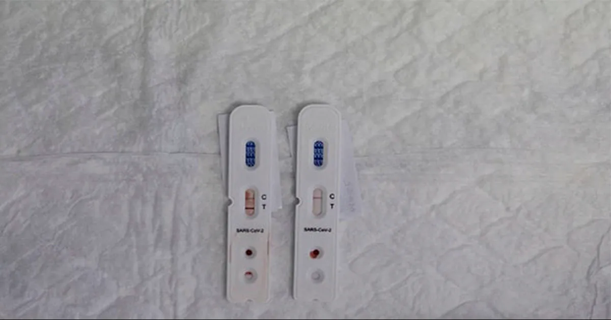 Una infección con el virus de Covid-19 debilita el sistema inmunitario a largo plazo, causando reducción significativa de las células inmunitarias.