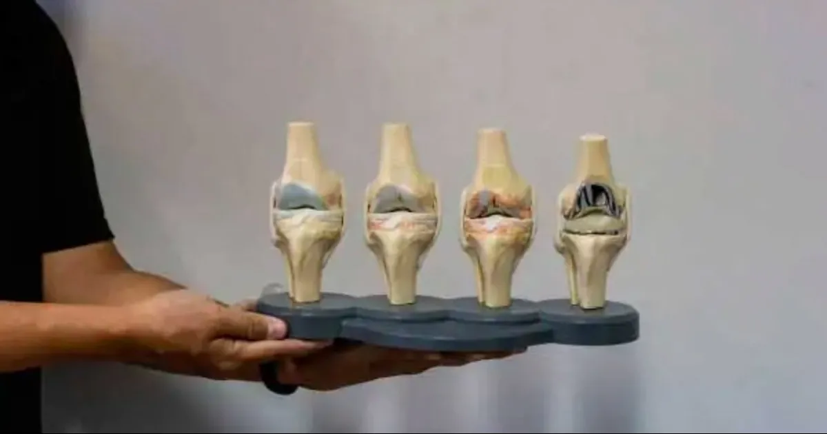 Programan cirugías de prótesis de cadera y rodilla en PN y Rosita a través de la beneficencia popular