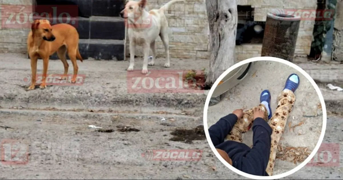 Este no es el primer incidente de este tipo, ya que la mujer había sido atacada en una ocasión anterior por el mismo animal.