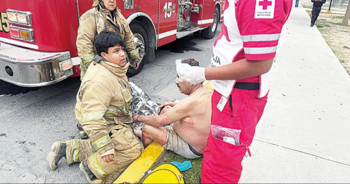 Don Alfredo protegió a su esposa de un daño mayor; quedó grave por las quemaduras.