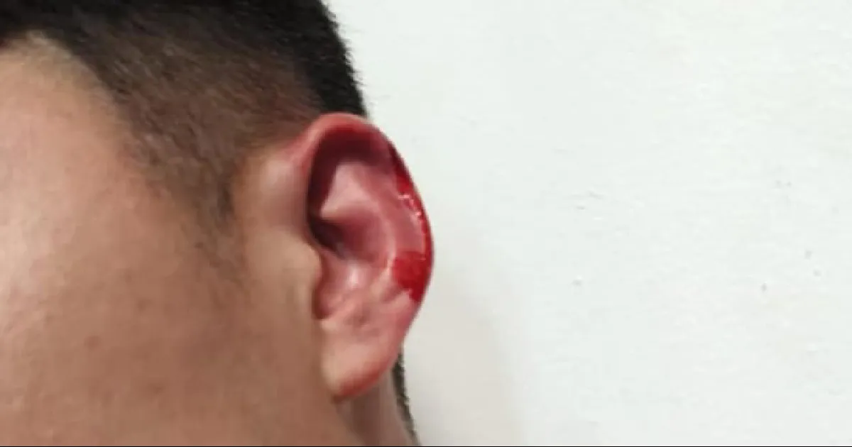 Denuncian a empleado del IMSS por agresión